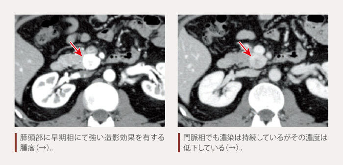 products_afinitor_net_diagnosis_05_zu1.jpg products_afinitor_net_diagnosis_05_zu1.jpg