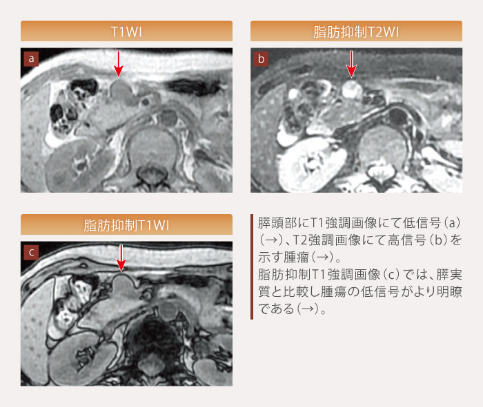 products_afinitor_net_diagnosis_05_zu2.jpg products_afinitor_net_diagnosis_05_zu2.jpg