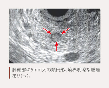 products_afinitor_net_diagnosis_05_zu3.jpg products_afinitor_net_diagnosis_05_zu3.jpg