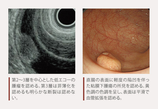 products_afinitor_net_diagnosis_05_zu4.jpg products_afinitor_net_diagnosis_05_zu4.jpg