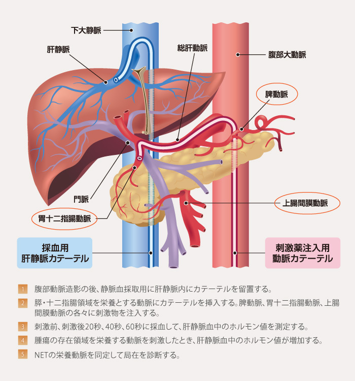 products_afinitor_net_diagnosis_05_zu5.jpg products_afinitor_net_diagnosis_05_zu5.jpg