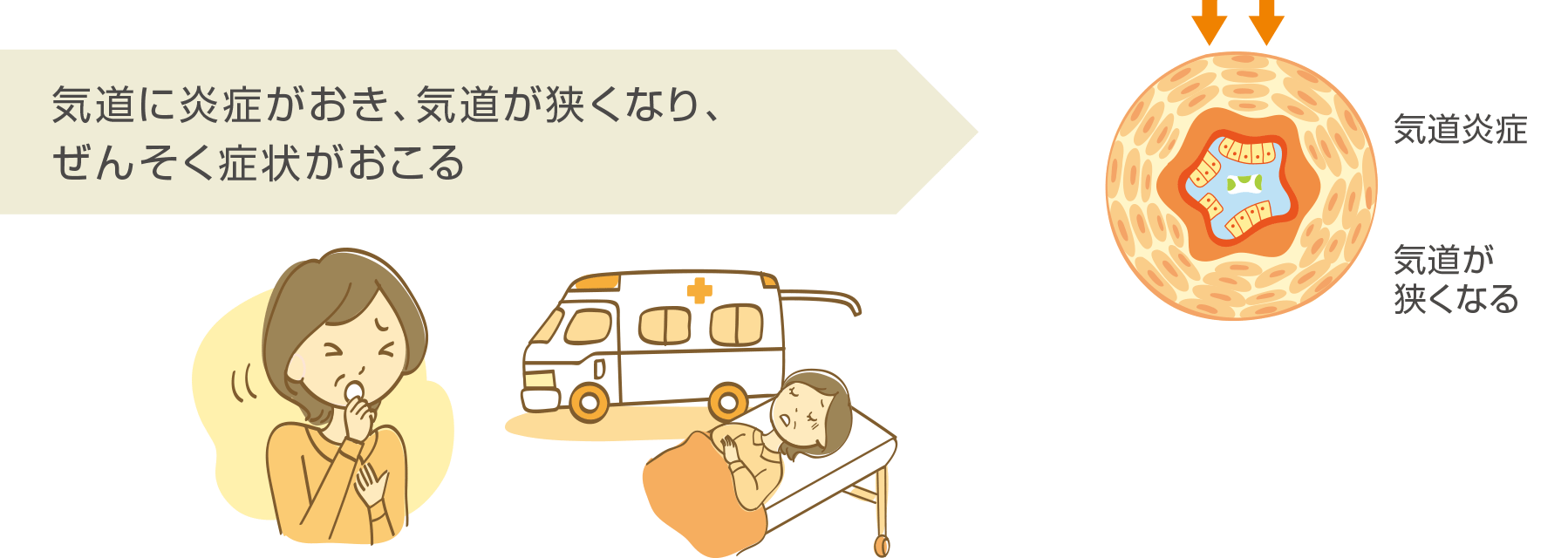 products_xolair_asthma_ic_img_a_ic_005.png products_xolair_asthma_ic_img_a_ic_005.png