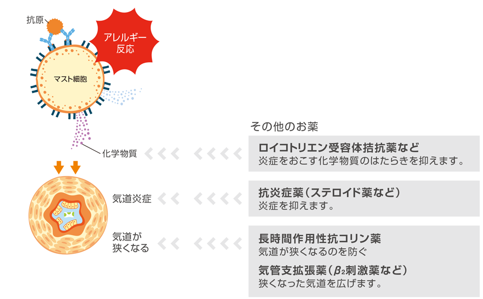 products_xolair_asthma_ic_img_a_ic_007_rev.png products_xolair_asthma_ic_img_a_ic_007_rev.png